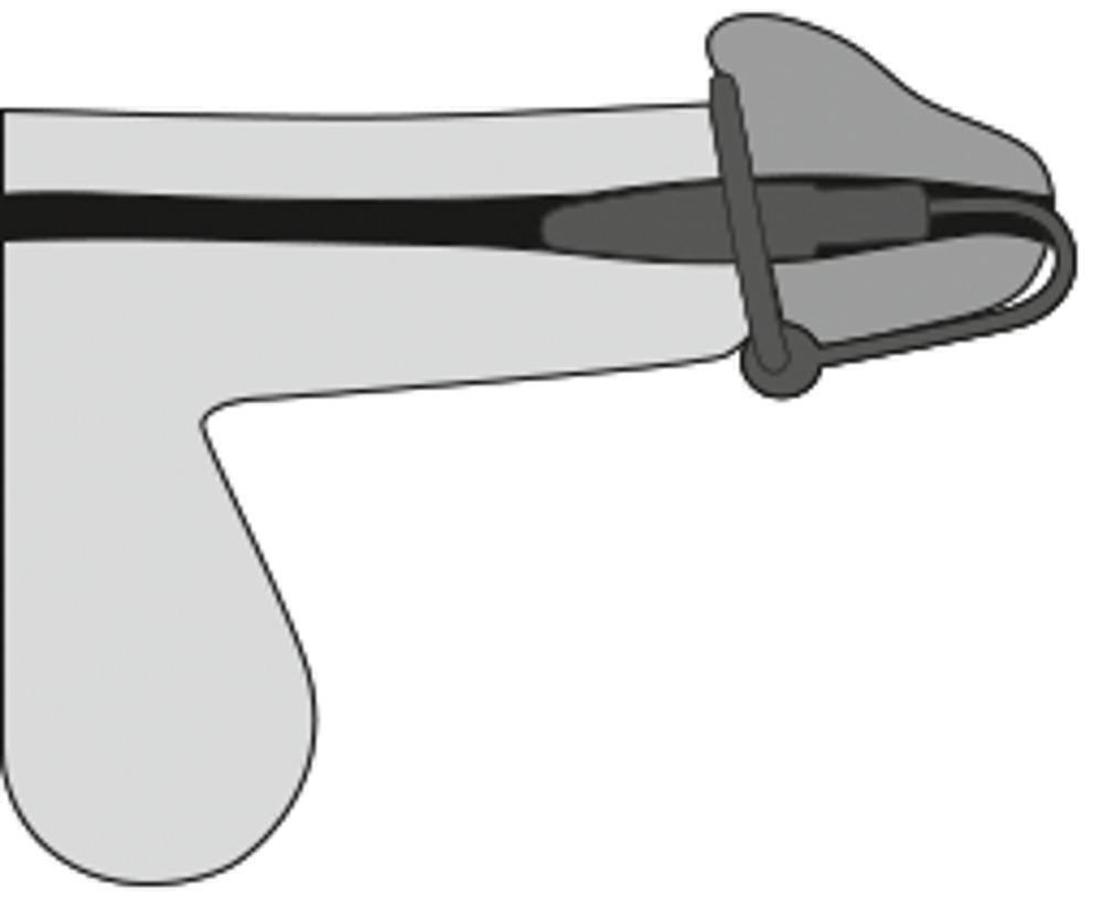 Уретральный стимулятор Orion Penis Plug с кольцом под головку, серебристый 